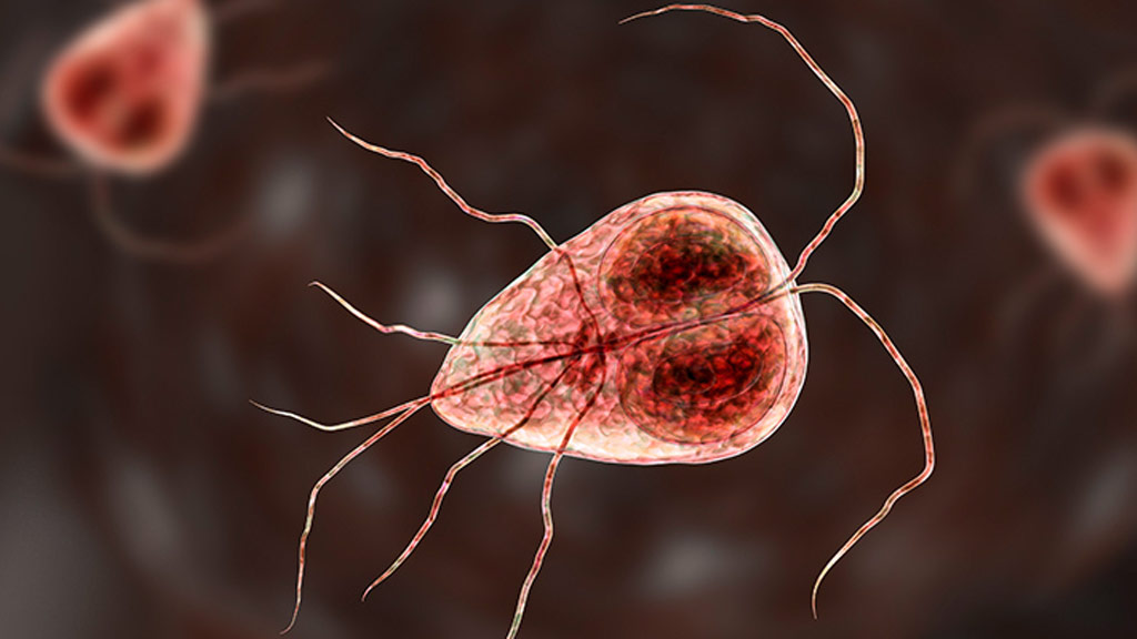 giardia